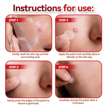 𝑉𝑠𝑜𝑥𝑎®💧Microneedles Botanical Skin Tags Solution Patches - Made in the USA👩‍⚕️