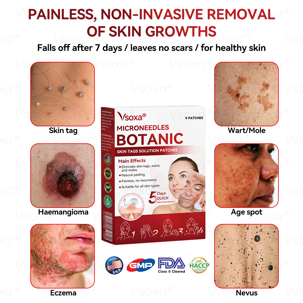 𝑉𝑠𝑜𝑥𝑎®💧Microneedles Botanical Skin Tags Solution Patches - Made in the USA👩‍⚕️